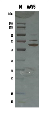 AAV 5